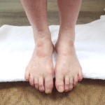 stig feet