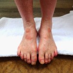 stig feet