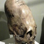 cone-head1