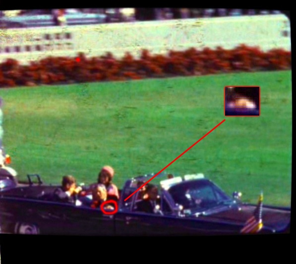 President Kennedy Assassination Pictures